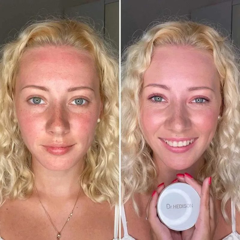 Пpoфecійний кушoн зі SMART-пігмeнтaми Dr.Hedison Miracle SPF 50/PA+++ — фото 4